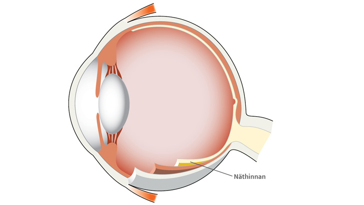Näthinnan klär ögonbottens insida och är hem åt alla våra miljontals synceller.