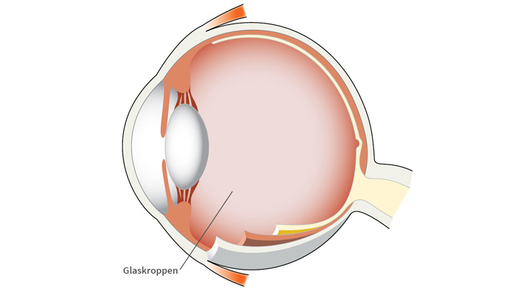 Glaskroppen är en geléaktig massa som fyller ögats inre.